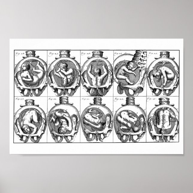Baby in womb Vintage Midwife anatomy illustration  Poster (Front)