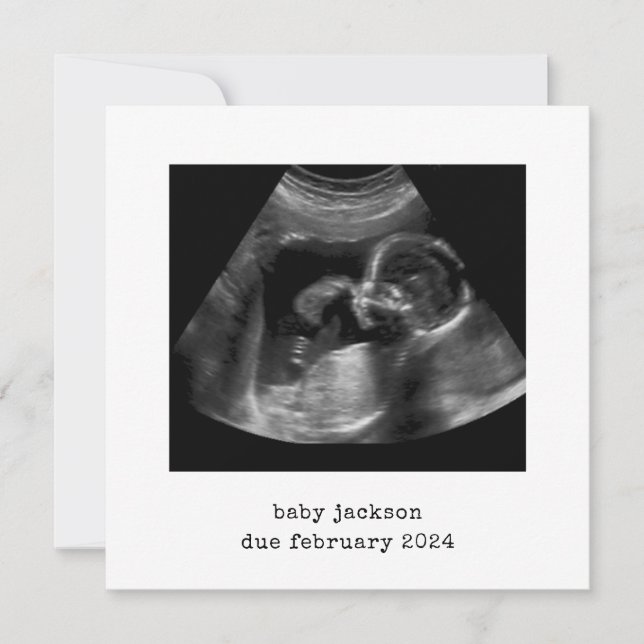 Baby Scan Photo Announcement Card (Front)