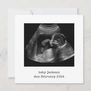 Baby Scan Photo Announcement Card