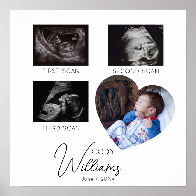  Baby Scan Photo sonogram newborn baby keepsake Poster (Front)