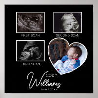  Baby Scan Photo sonogram newborn baby keepsake