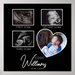  Baby Scan Photo sonogram newborn baby keepsake Poster