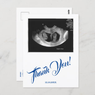 Baby Shower Ultrasound Boy Blue Thank You. Postcard