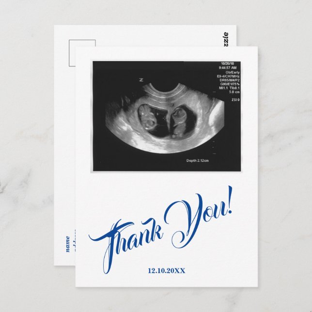 Baby Shower Ultrasound Boy Blue Thank You. Postcard (Front/Back)