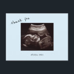 Baby Shower Ultrasound Cute Icy Blue Thank You Postcard<br><div class="desc">Ultrasound Photo Thank You Postcard.  Custom Message on the back.   Cute Font. Icy blue background.</div>