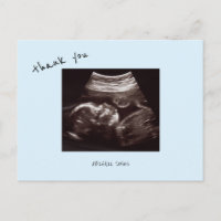  Baby Shower Ultrasound Cute Icy Blue Thank You