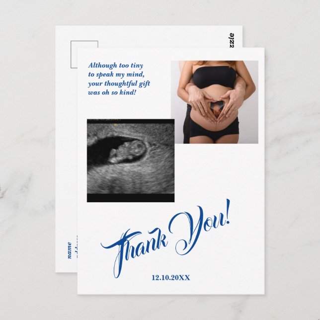 Baby Shower Ultrasound Girl Pink Thank You. Postcard (Front/Back)