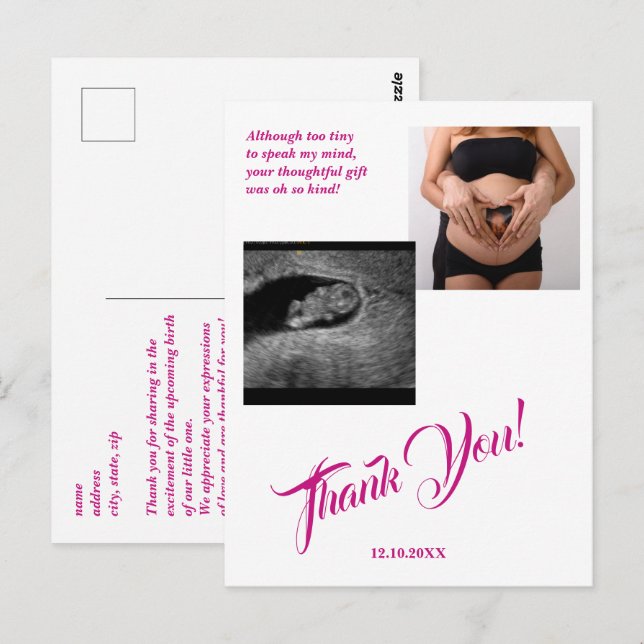 Baby Shower Ultrasound Girl Pink Thank You. Postcard (Front/Back)