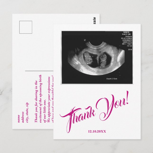 Baby Shower Ultrasound Girl Pink Thank You. Postcard (Front/Back)