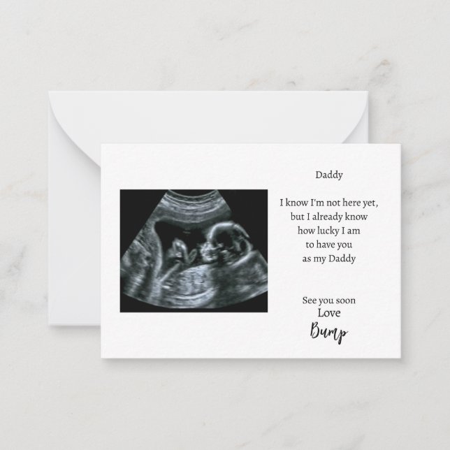 Baby Sonogram Card for Daddy (Front)