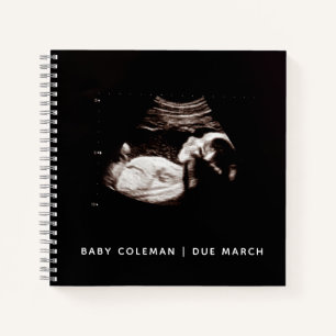 Baby Sonogram Personalised Memory Pregnancy Book