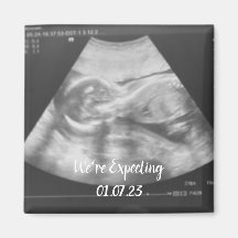 baby ultrasound announcement 