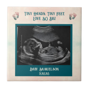 Baby Ultrasound Keepsake Gift Box Tile