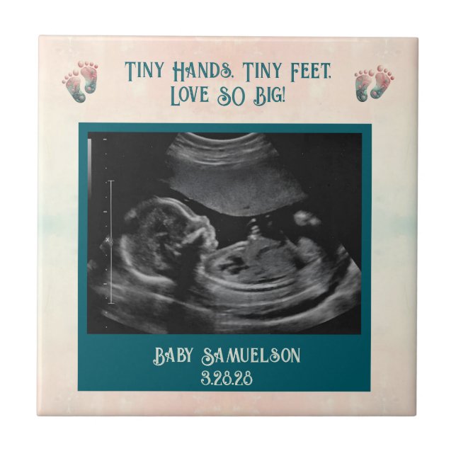 Baby Ultrasound Keepsake Gift Box Tile (Front)