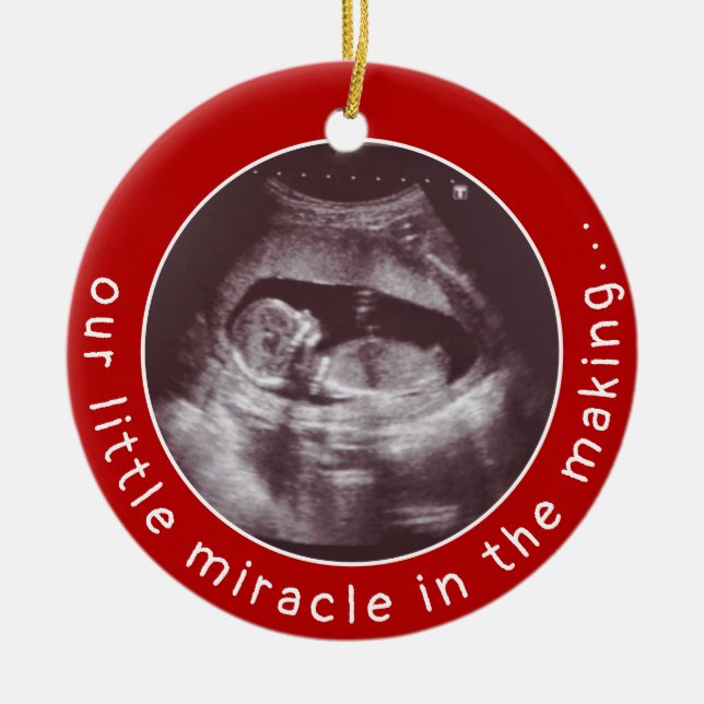 Baby Ultrasound Photo Red Miracle Christmas Ceramic Tree Decoration (Front)