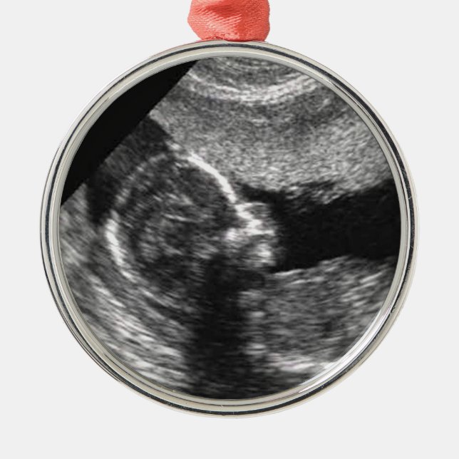 Baby's 1st Christmas Metal Tree Decoration (Front)