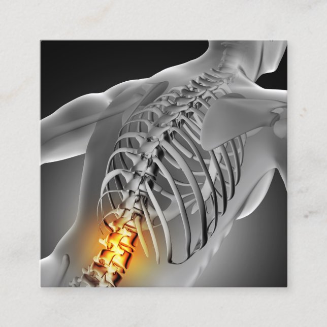 Back Pain Photo Graphic Square Chiropractic Square Business Card (Front)