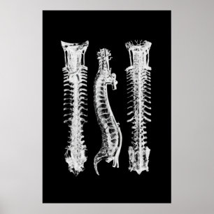 Backbone Anatomy Wall Decor Medical Art Poster