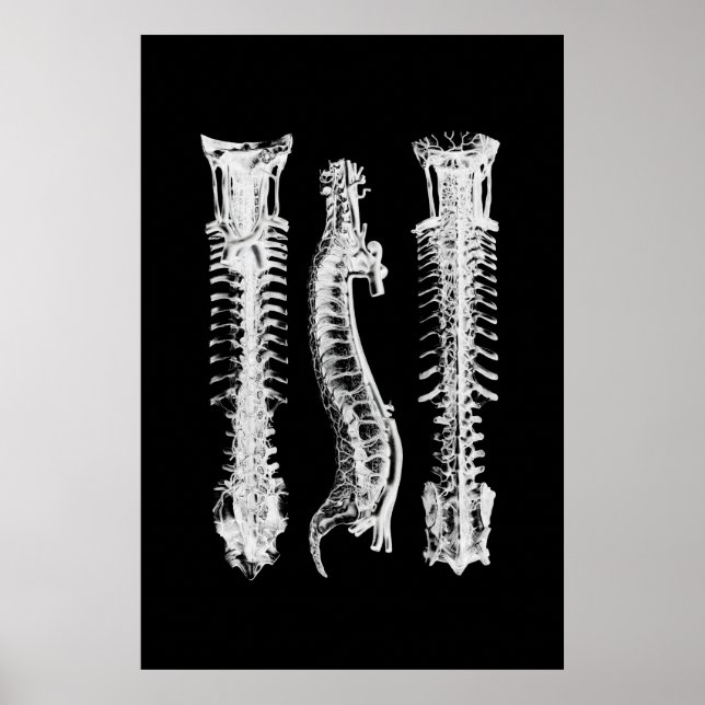 Backbone Anatomy Wall Decor Medical Art Poster (Front)