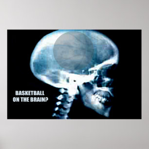 Basketball Head (X-ray) Poster