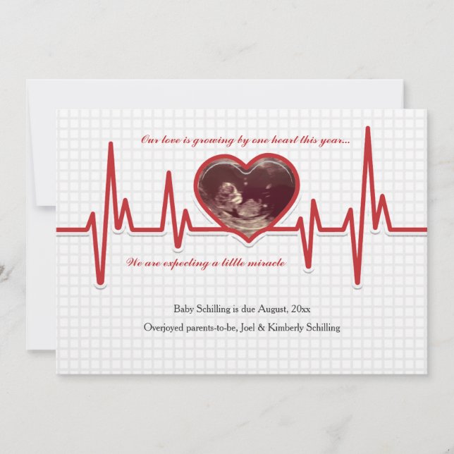 Beating Heart Photo Pregnancy Announcement Custom (Front)