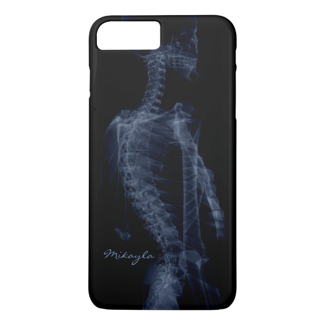 Beautiful, Personalised Body X-Ray Case-Mate iPhone Case (Back)