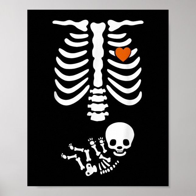 Beer Belly &amp; Baby Skeleton Pregnancy Couples H Poster (Front)