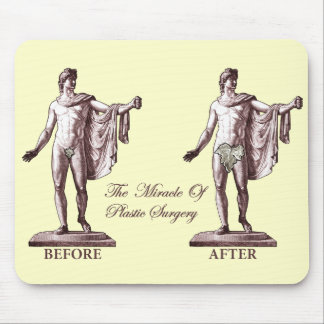 Before and After Mouse Mat