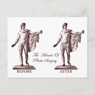 Before and After Postcard