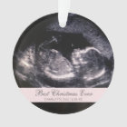 Best Christmas Ever Cute Ultrasound Girl Photo