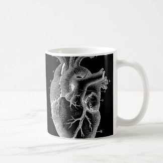 Black Anatomical Heart Coffee Mug