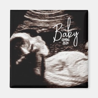 Black and White Baby Ultrasound Birth Announcement Magnet
