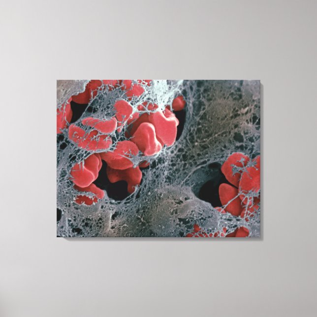 Blood Clot 2 Canvas Print (Front)