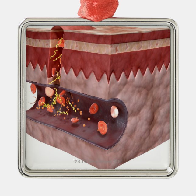 Blood Clot Formation Metal Tree Decoration (Front)