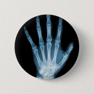 Blue X-ray Skeleton Hand 6 Cm Round Badge