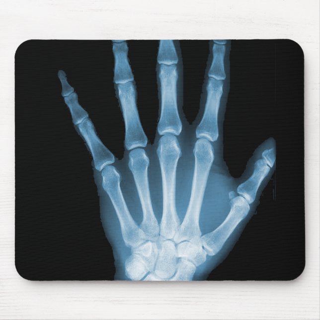 Blue X-ray Skeleton Hand Mouse Mat (Front)
