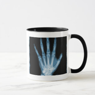 Blue X-ray Skeleton Hand Mug