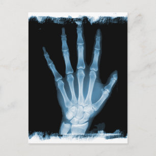 Blue X-ray Skeleton Hand Postcard