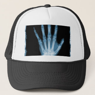 Blue X-ray Skeleton Hand Trucker Hat