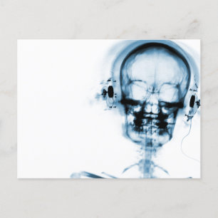Blue X-Ray Vision Music Skeleton Skull Postcard