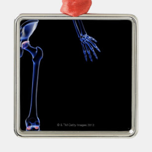 Bones of the Hip Metal Tree Decoration