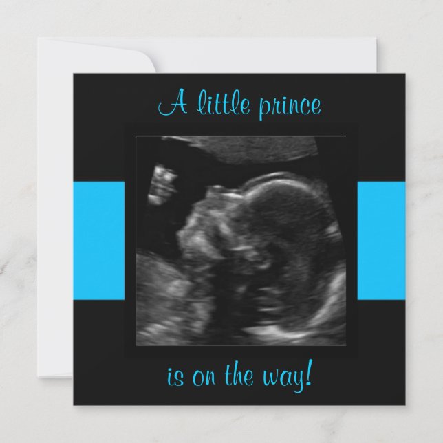 Boy Baby Customised Ultrasound Photo Template (Front)