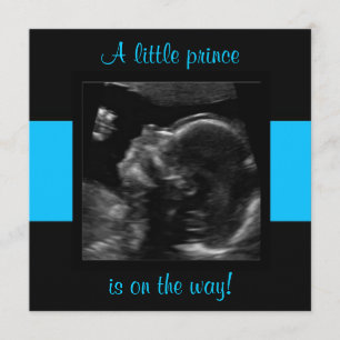 Boy Baby Customised Ultrasound Photo Template