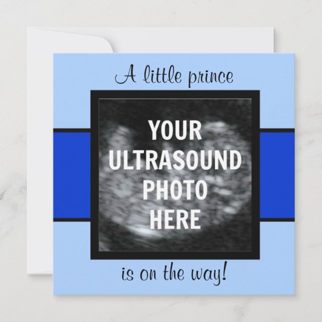 Boy Baby Customised Ultrasound Photo Template (Front)