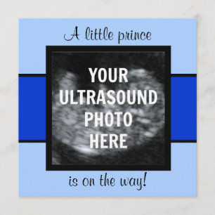 Boy Baby Customised Ultrasound Photo Template