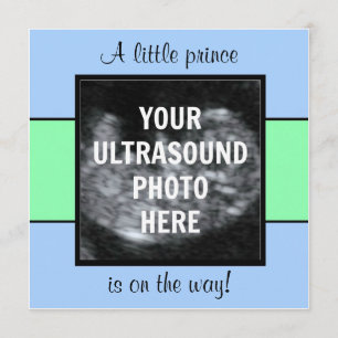 Boy Baby Customised Ultrasound Photo Template