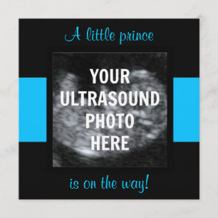 Boy Baby Customised Ultrasound Photo Template