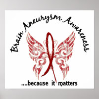 Brain Aneurysm Butterfly 6.1