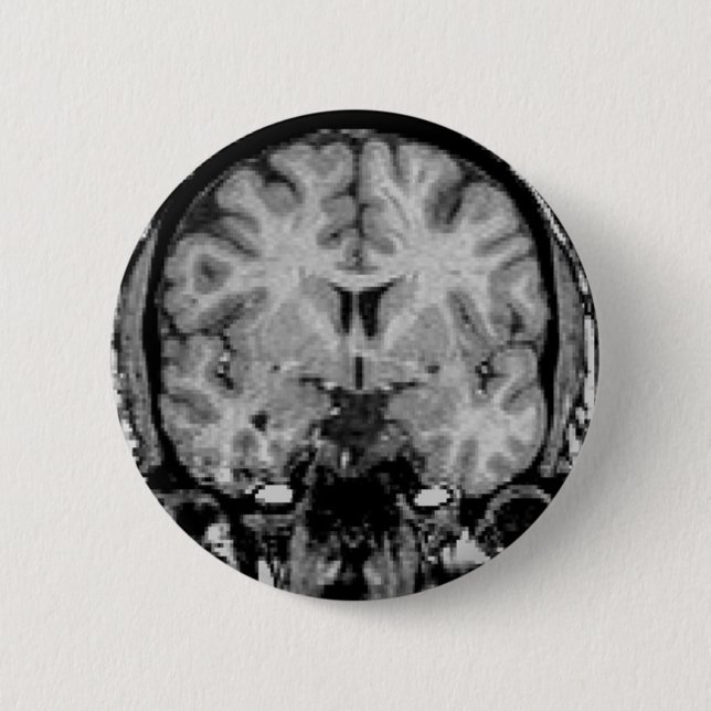 Brain MRI, coronal slice 6 Cm Round Badge (Front)