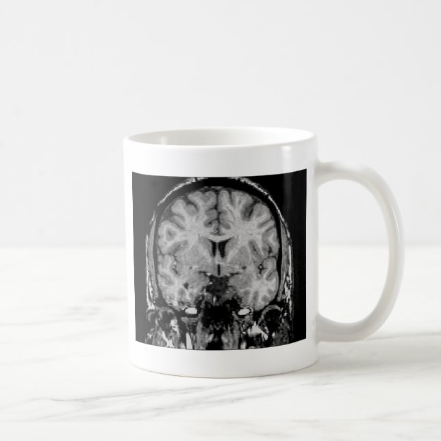 Brain MRI, coronal slice Coffee Mug (Right)